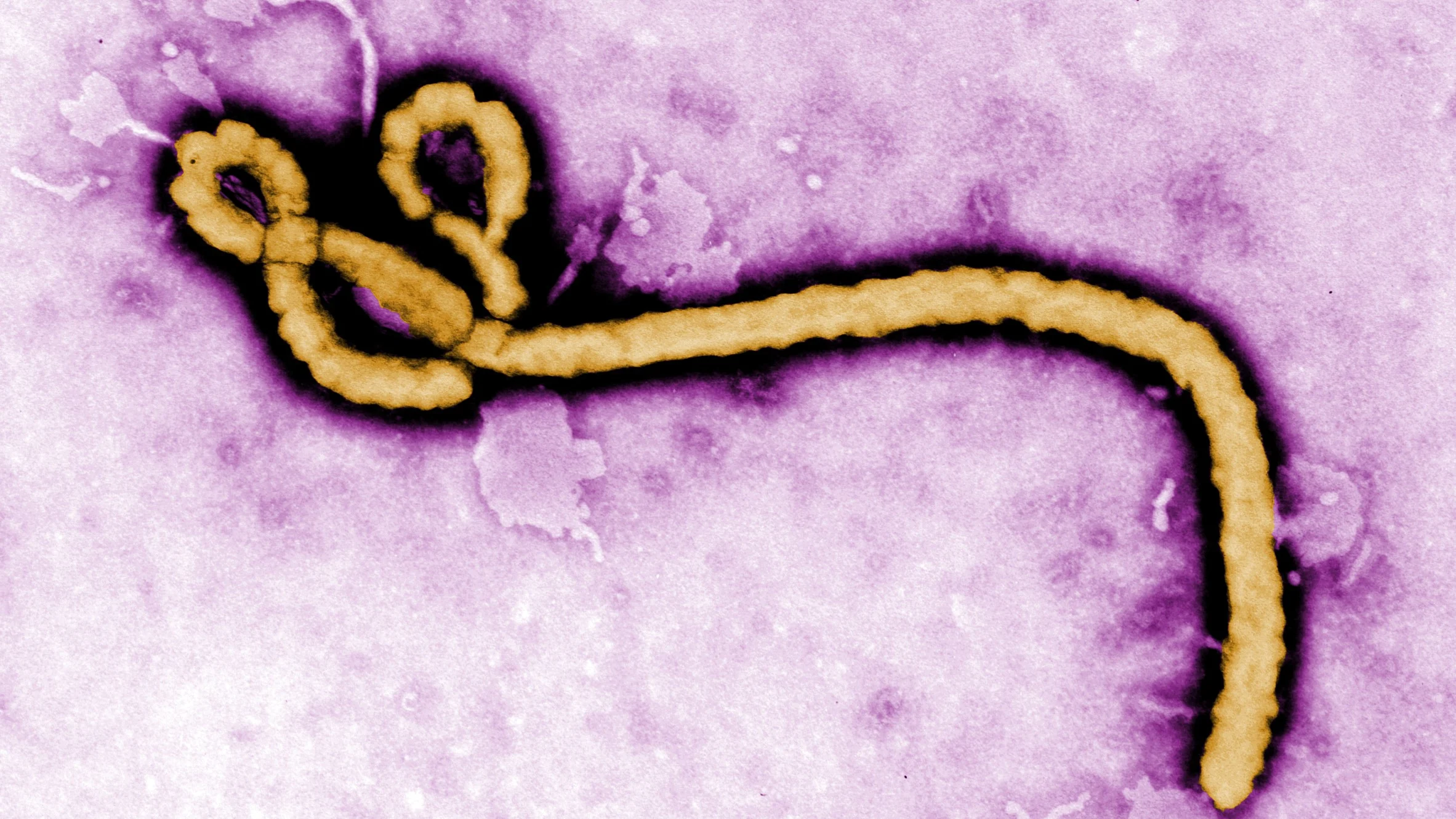 WHO Ebola Vaccine Trial in DRC